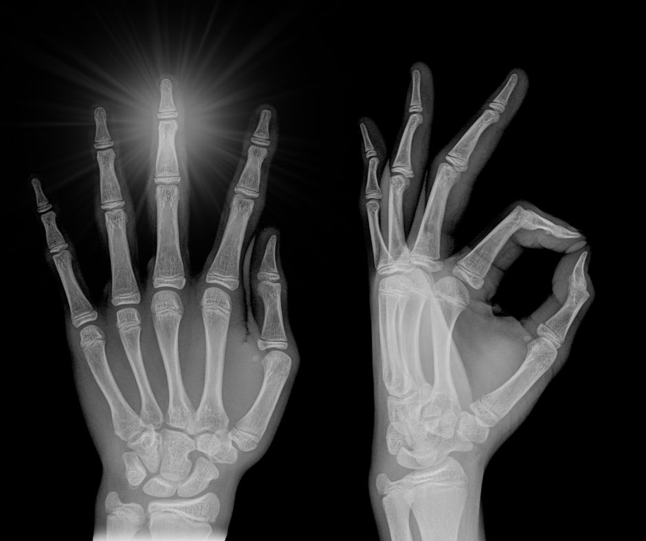 I’m Selling My Middle Finger for $1.5 Million