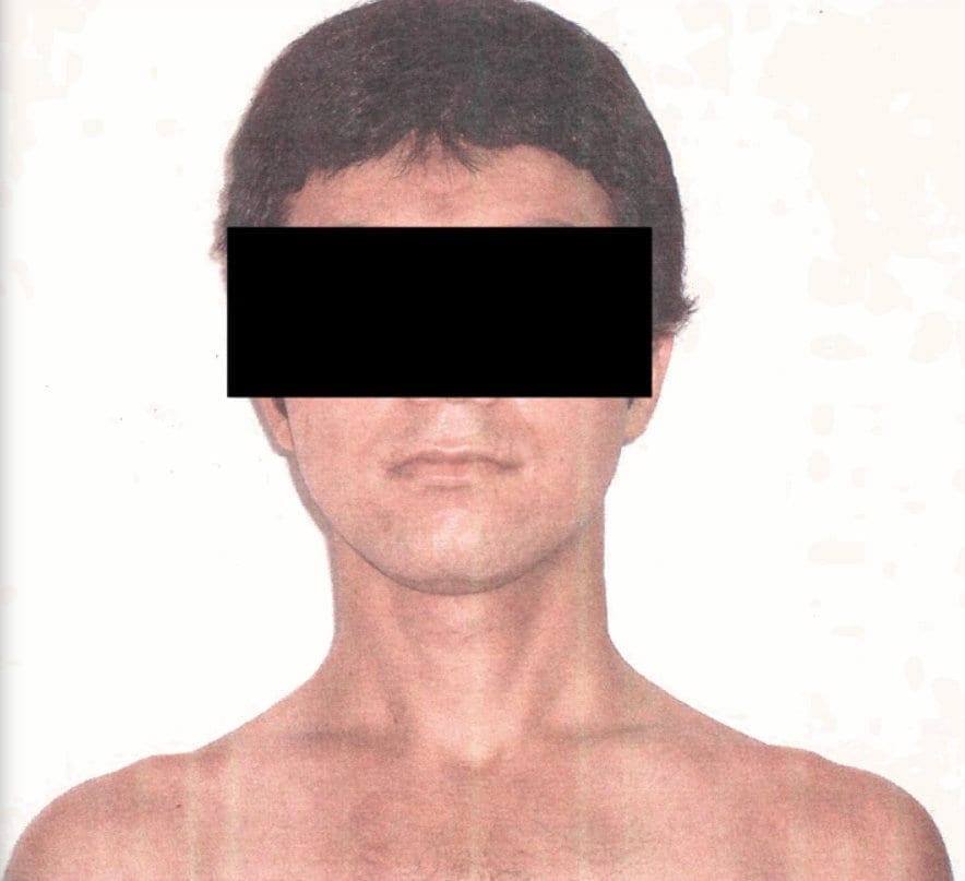 As Presidential Candidates Promise to Use Torture, Pentagon Releases Photos of Detainee Abuse